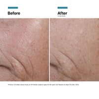 SkinCeuticals Prevent C E Ferulic 30ml