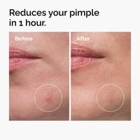 The Ordinary Sulfur 10% Powder-To-Cream Concentrate 5g