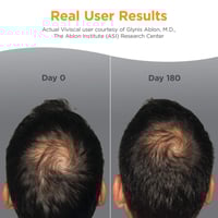 Viviscal Man Healthy Hair Vitamins Supplement Tablets x60