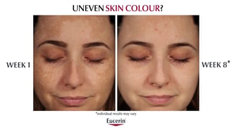 Eucerin Anti-Pigment Range - Reduce Skin Hyperpigmentation
