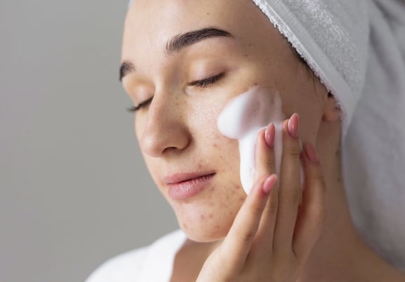 What Are the Best Acne Products for Sensitive Skin?