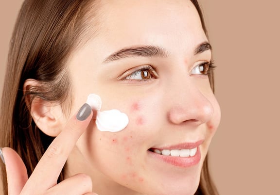 Best Acne Products For Sensitive Skin
